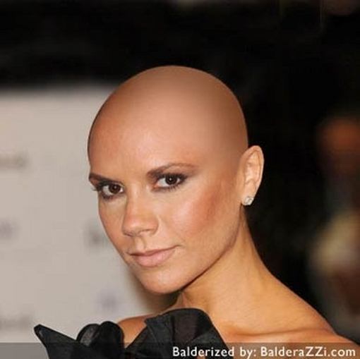 What if your Favorite Celebs were bald?
