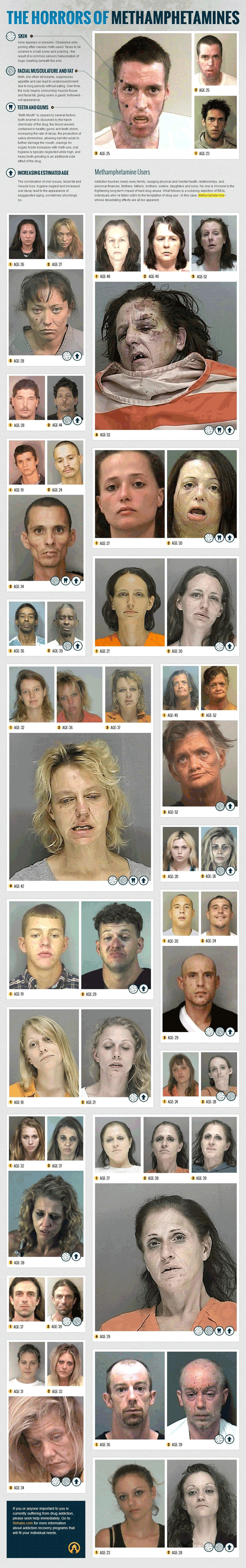 Meth Users - Horrific Before & After Photographs 