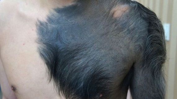 They Caught A Real Life Werewolf!