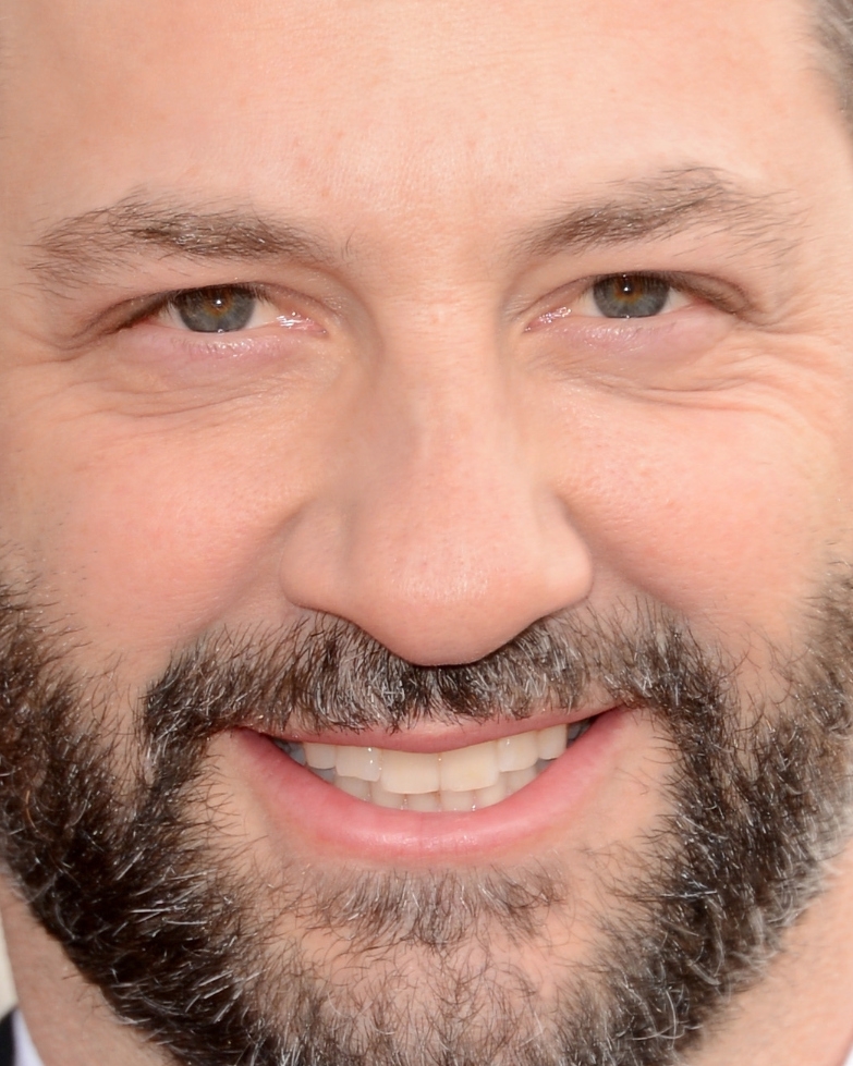 Best Extreme Closeups At The Golden Globes