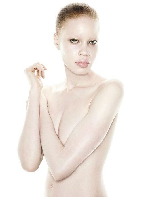 South African Albino Model Makes It To The Top Of The Industry!