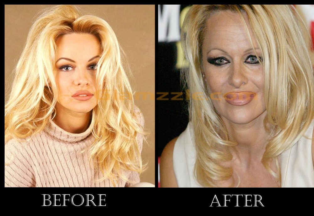 What Happened To Pamela Anderson?!