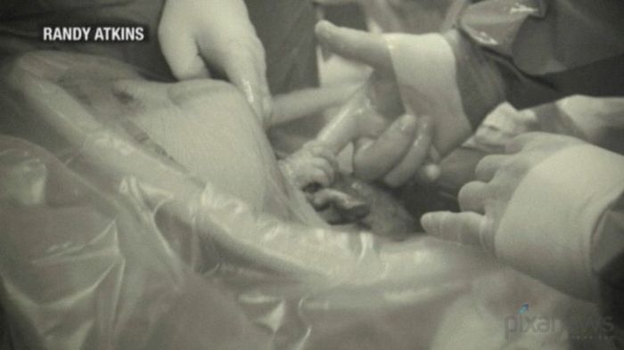 Handshake from the Womb 