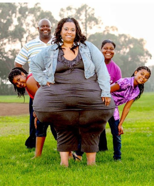 The woman with the world’s widest hips 