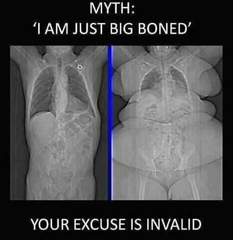 The Good Ol' 'Big Boned' Excuse
