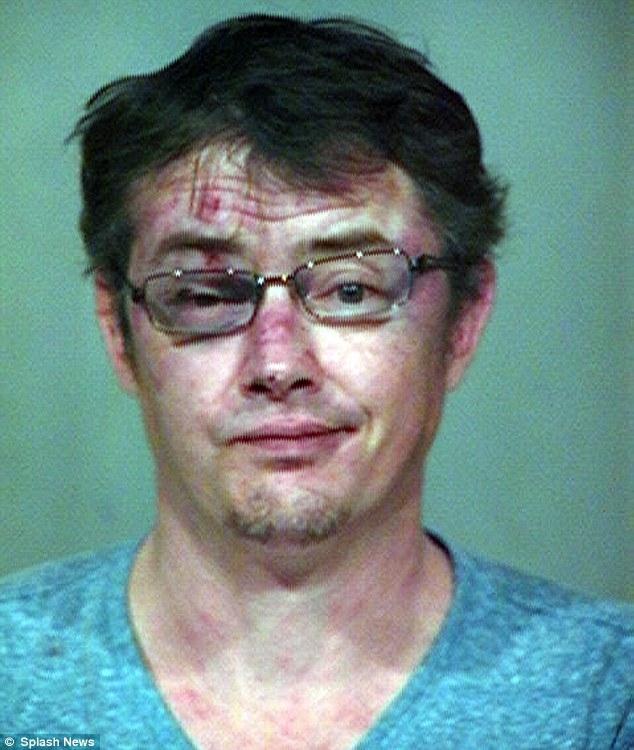Jason London shows off his bruised and swollen face