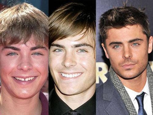 The Evolution Of Zac Efron 