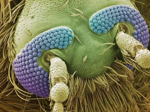 Things You Never Want To See Under A Microscope 