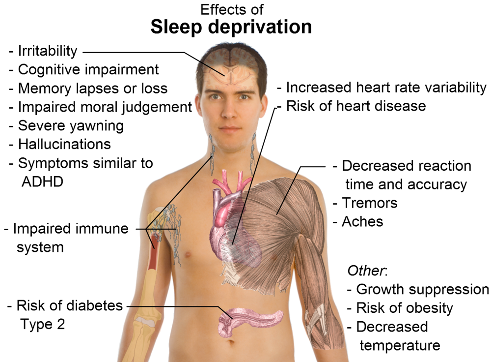 New Research Uncovers The Real Damage Of Sleep Deprivation.