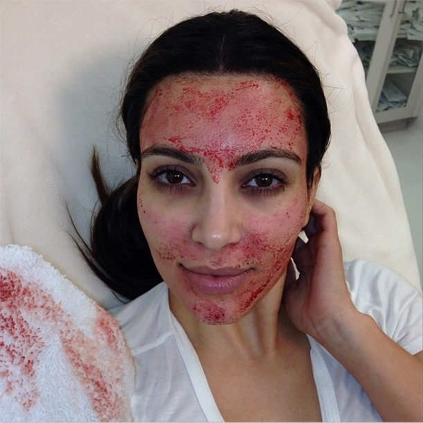 Kim Kardashian Covered In Blood