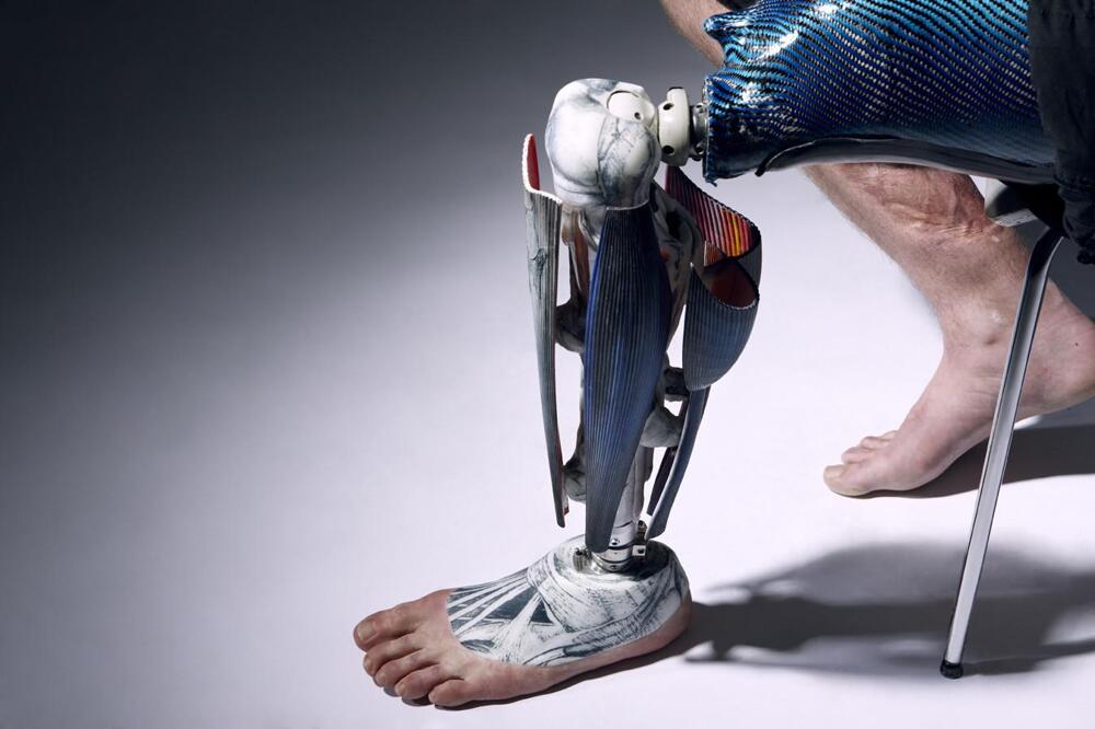 WTF of the Day - The Alternative Limb Project, Surreal Prostheses 