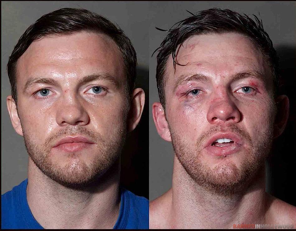 Boxers Before and After Fight 