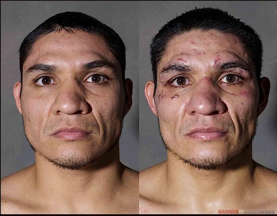 Boxers Before and After Fight 