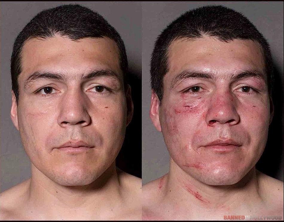 Boxers Before and After Fight 