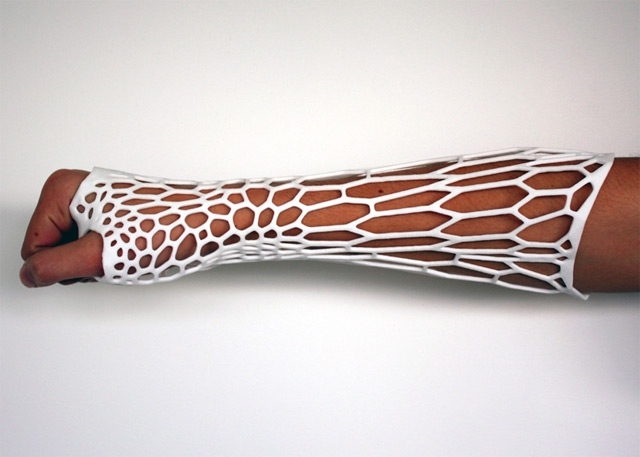 3D-Printing Technology Produces Modern Exoskeletal Cast 