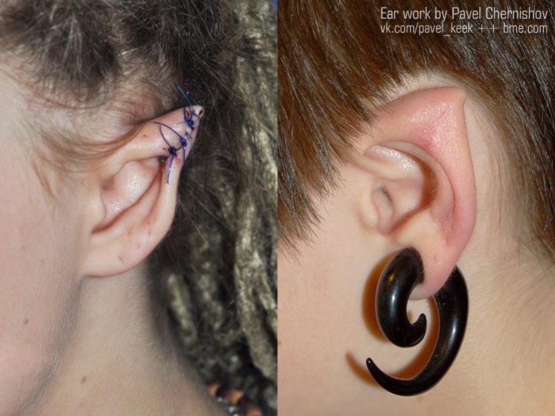 Outrageous Body Modifications Are On The Rise. Wtf's Guaranteed!