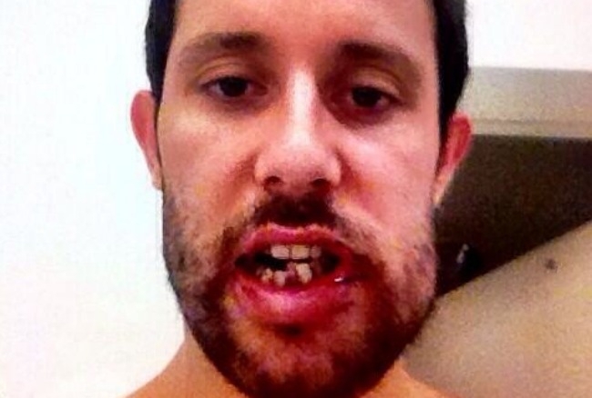 A Stick To The Face Turned Edmonton Oiler Sam Gagner Into A Monster