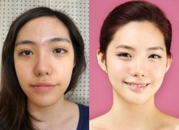 Plastic surgery in South Korea: before and after