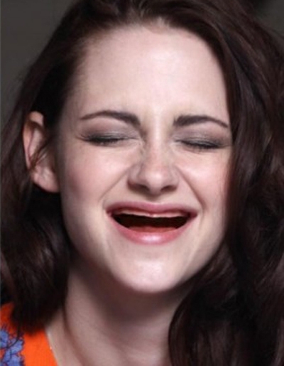 22 Celebrities Without Teeth