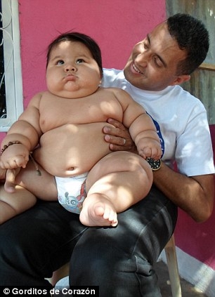 Colombia's fattest baby who weighs the same as a six-year-old rescued 