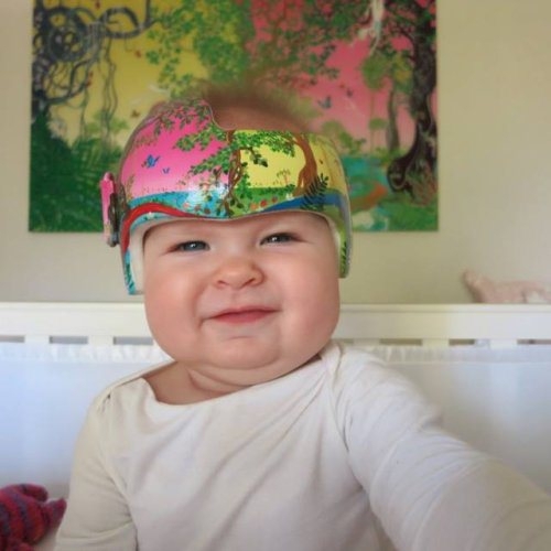 Required baby helmets become a great accessory thanks to a little art 