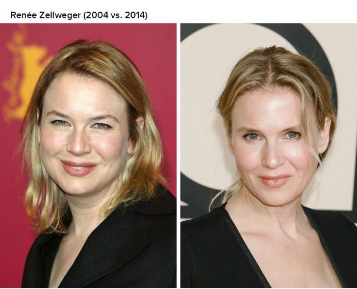 Celebrities That Are Aging In Reverse