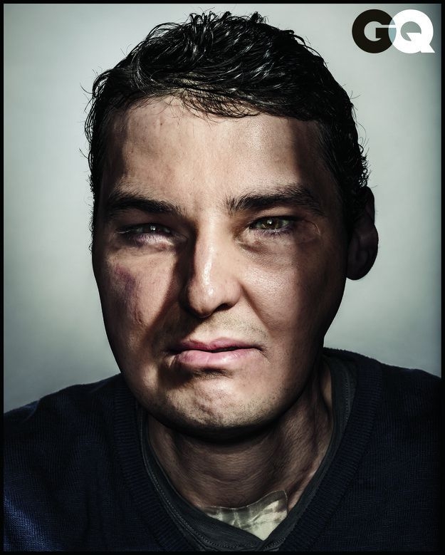 A Man Who Had A Face Transplant Now Looks Fantastic In GQ Magazine