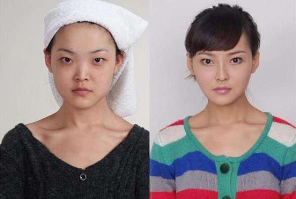 Plastic surgery is all the rage in China