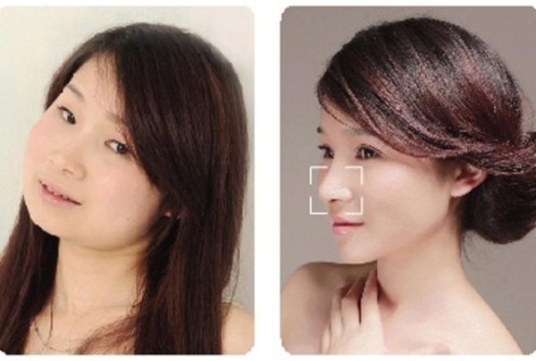 Plastic surgery is all the rage in China