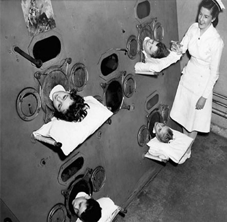 15. Stacking up polio sufferers in a multi-person iron lung, circa 1950.