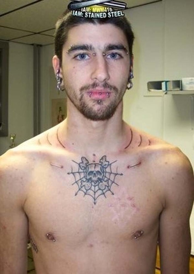 More scarification, this time on the shoulders.