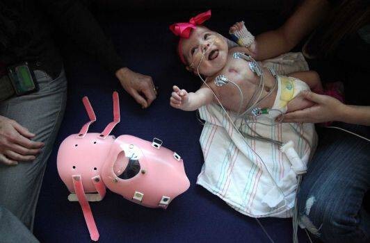 Here's How This Girl Born With Her Heart Outside Her Chest Managed To Survive