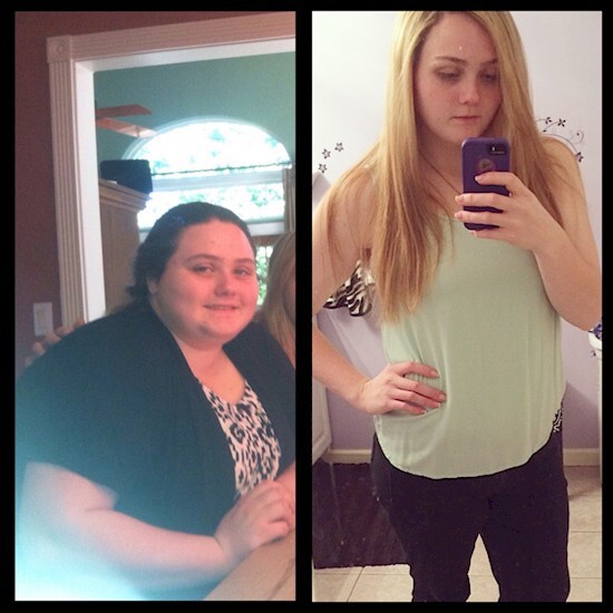  Reddit user ArcticxM00N129 lost 144 lbs., going from 305 to 161 lbs.