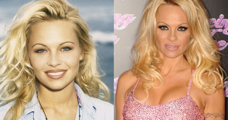 12 Celebrities Who Looked Better Before Going Under The Knife
