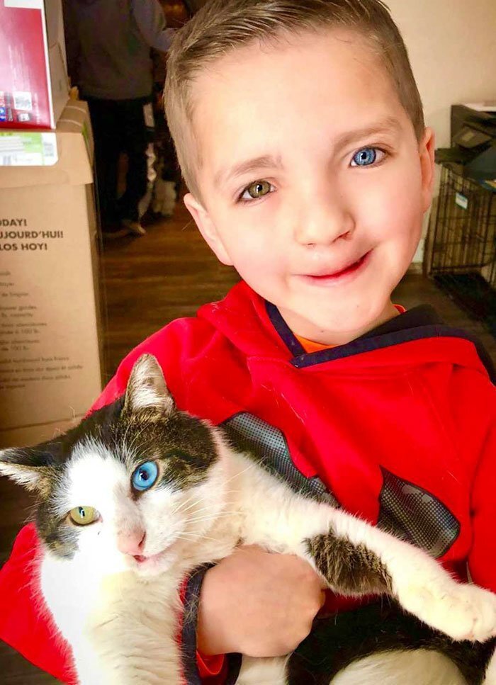 Both were born with a cleft lip paired with a rare eye condition called heterochromia iridum, existing in less than 1% of the population