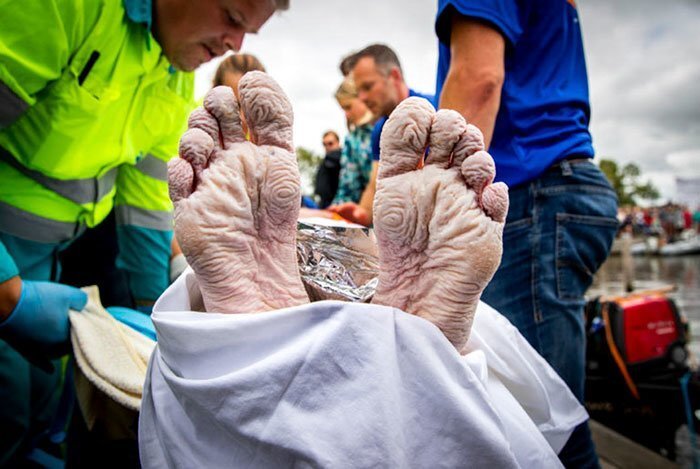 The Way This Man’s Body Looks After Swimming 163 Km In 55 Hours Will Freak You Out