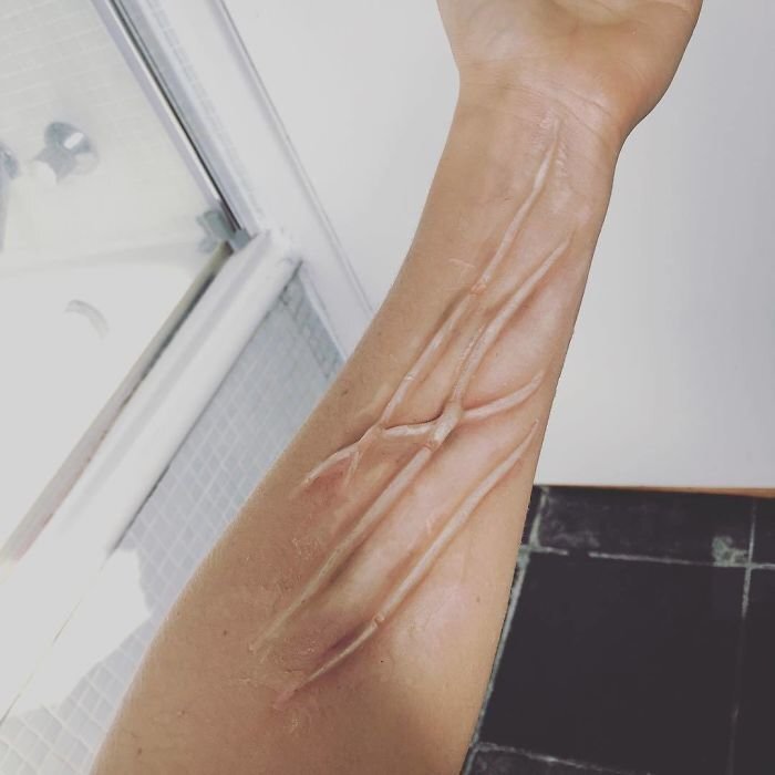 Celebrities Are Getting Temporary Skin “Implants” And It’s Freaking People Out
