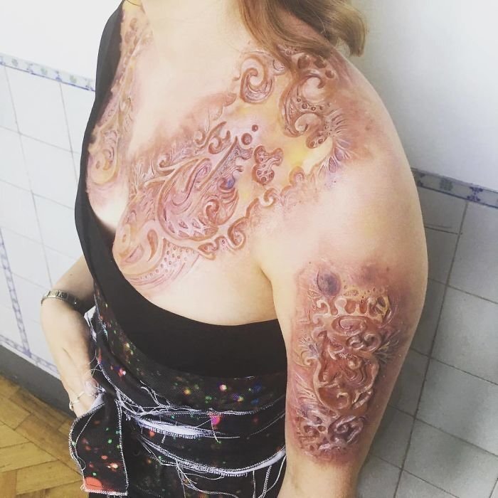 Celebrities Are Getting Temporary Skin “Implants” And It’s Freaking People Out
