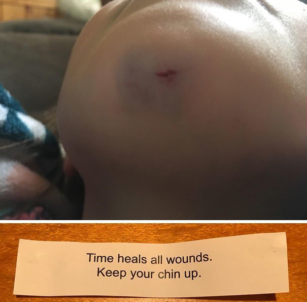 #4 My Daughter Injured Her Chin Today And At Dinner Received This Fortune Cookie