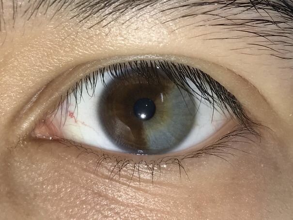#19 My Left Eye Is About 1/3 Grey
