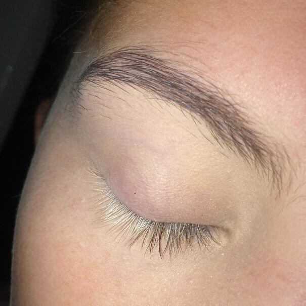 #37 Half Of The Eyelashes On My Right Eye Are White