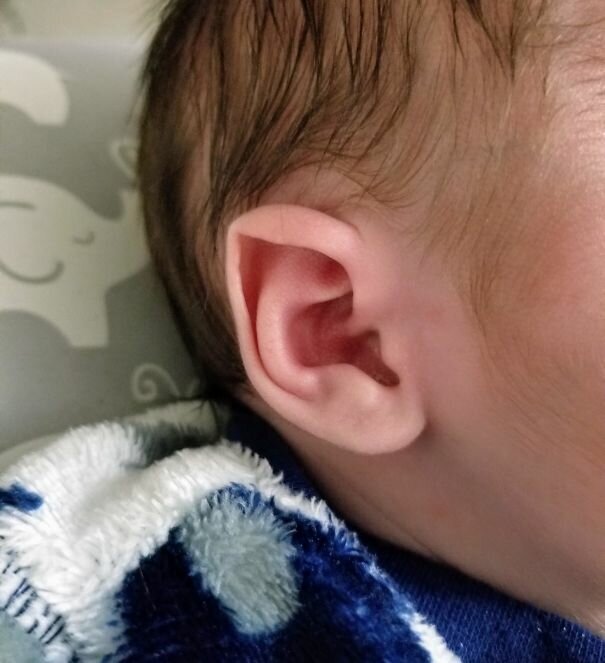 #18 My Son Was Born With Natural Elf Ears