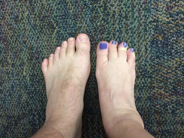 #17 I Was Born With 6 Toes On My Left Foot And My Co-Worker Was Born With 4 Toes On Her Right Foot