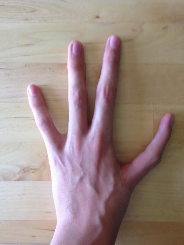 #5 I Have Only Four Fingers On My Left Hand, And Have And Index Finger Instead Of My Thumb