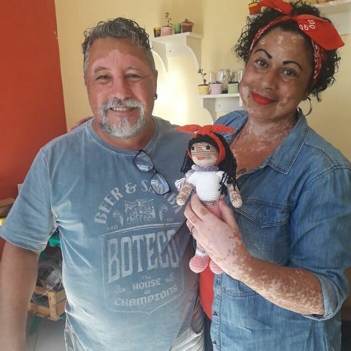 Grandpa With Vitiligo Crochets Dolls To Encourage Kids Who Suffer From This Condition