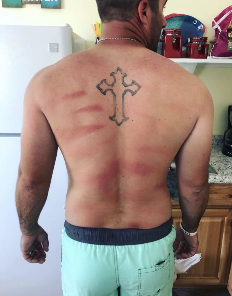 7. This wife, who helped her husband put sunscreen on his back and missed a few spots: