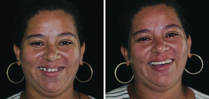 Brazilian Dentist Travels To Treat The Teeth Of Poor People For Free And Here Are 30 Transformations