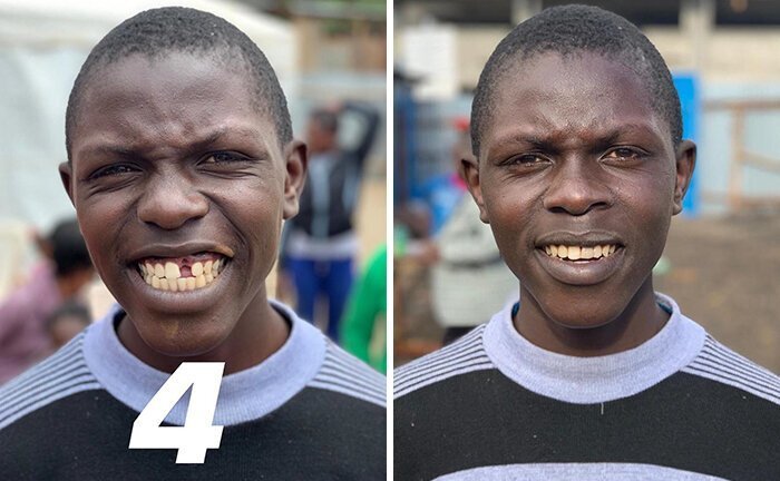 Brazilian Dentist Travels To Treat The Teeth Of Poor People For Free And Here Are 30 Transformations