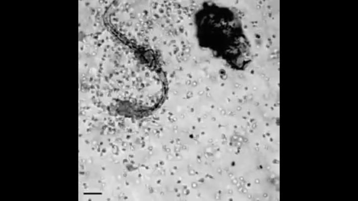 Как лейкоциты атакуют червя-паразита 