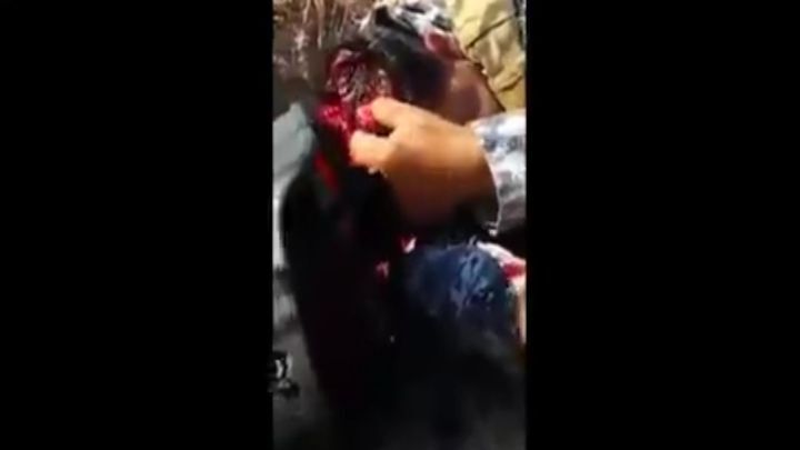 Иракский солдат в предсмертном состоянии хватает себя за мозги 